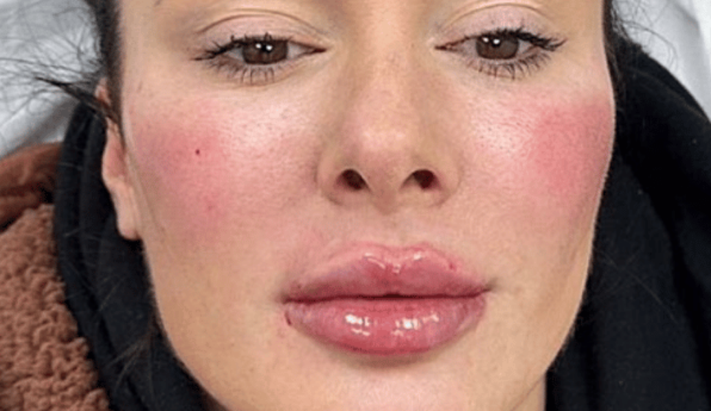 After - Dollface Cosmetics