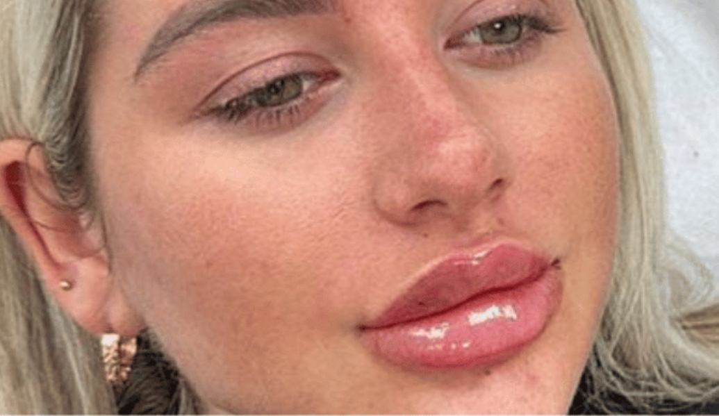 After - Dollface Cosmetics