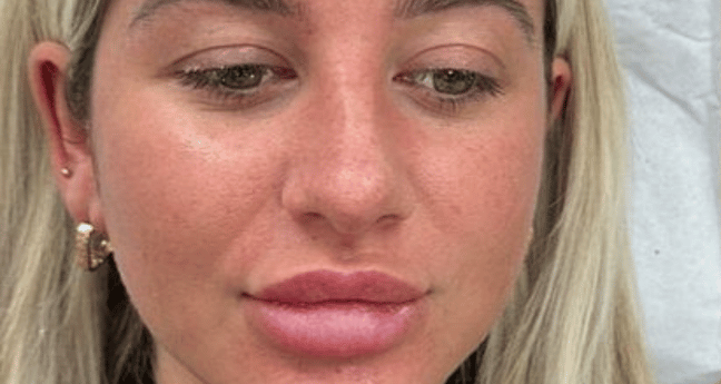 Before - Dollface Cosmetics