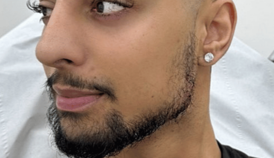 After - Dollface Cosmetics