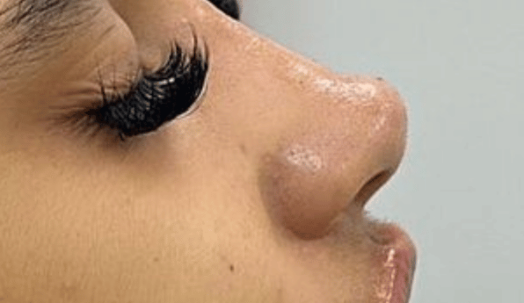 After - Dollface Cosmetics