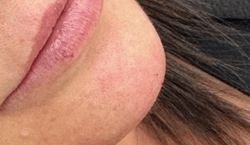 After - Dollface Cosmetics