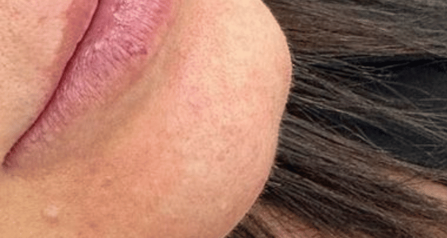 Before - Dollface Cosmetics