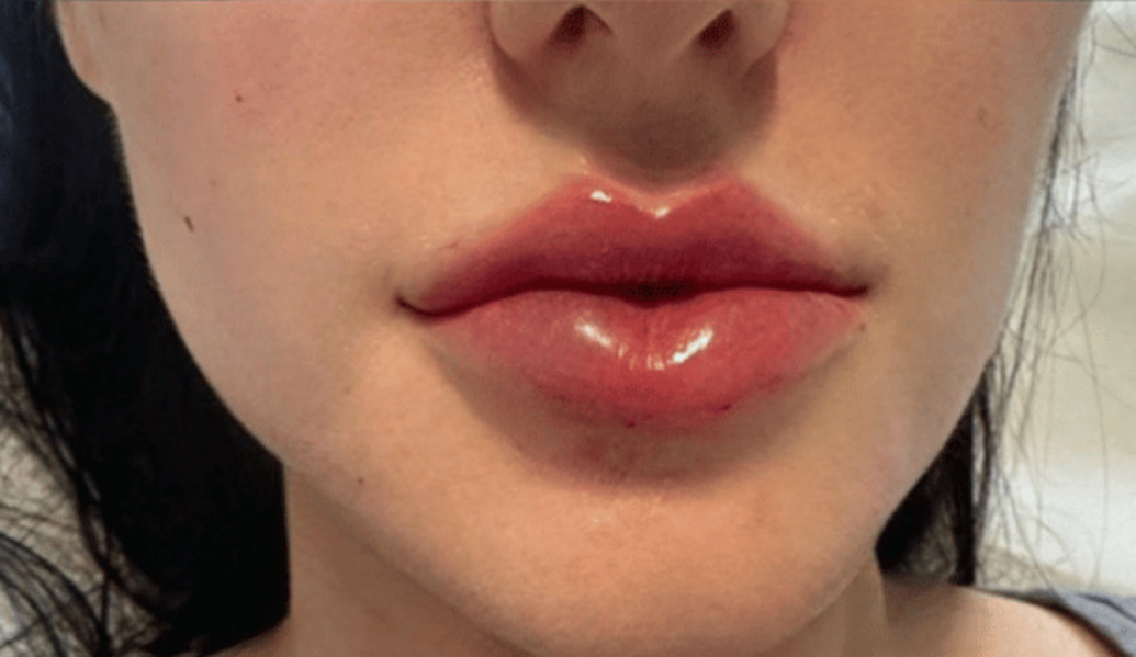 After - Dollface Cosmetics