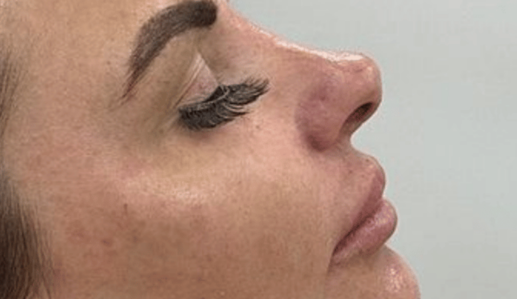 After - Dollface Cosmetics