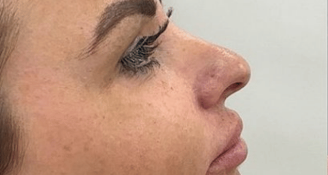 Before - Dollface Cosmetics