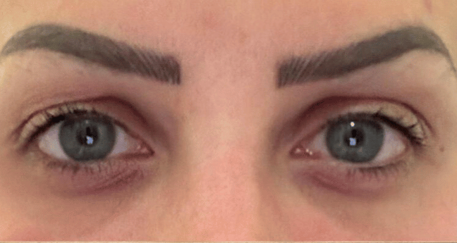 Before - Dollface Cosmetics