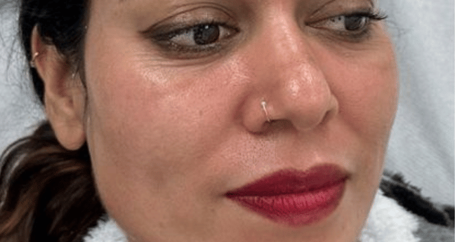 Before - Dollface Cosmetics